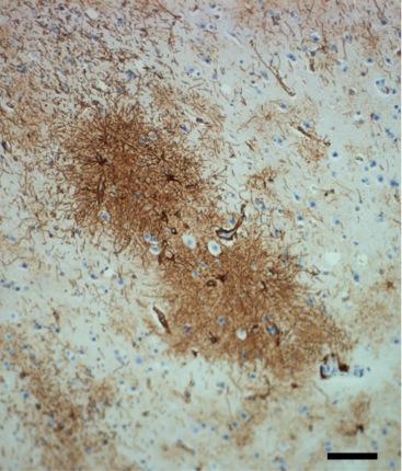 staining for GFAP, a marker of astrocytes.