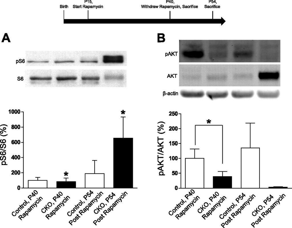 Figure 2.4 Rapamycin treatment normalizes mtorc1 but not mtorc2 signaling in Tsc1 CKO kidneys. Two groups of animals were treated with rapamycin from P15 to P40.