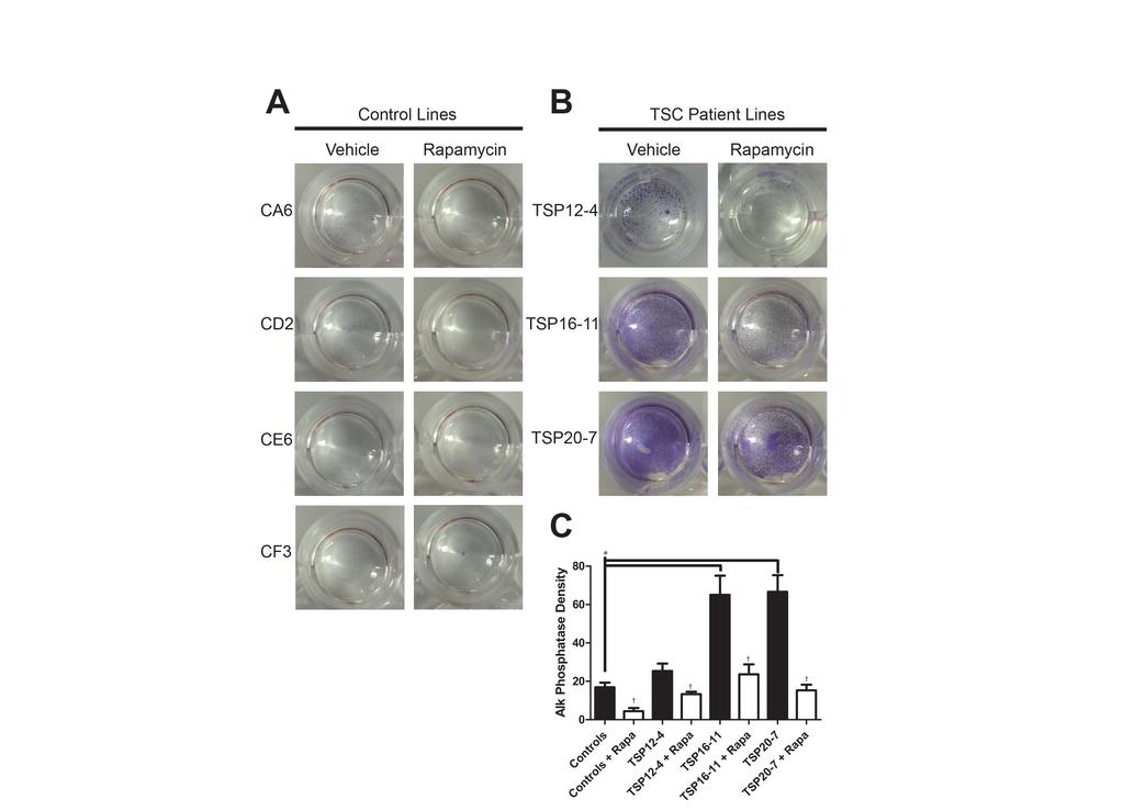 ! Figure 3.2 TSC Patient Derived ipscs have increased survival and maintenance of pluripotency 3 days after single cell suspension.