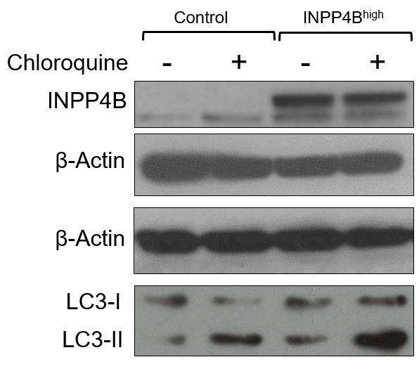 A B Figure 13. OCI-AML3 INPP4B wt have a greater propensity for autophagosome biogenesis. (A) Immunoblot characterizing the amount of LC3 accumulated in OCI- AML3 cells.