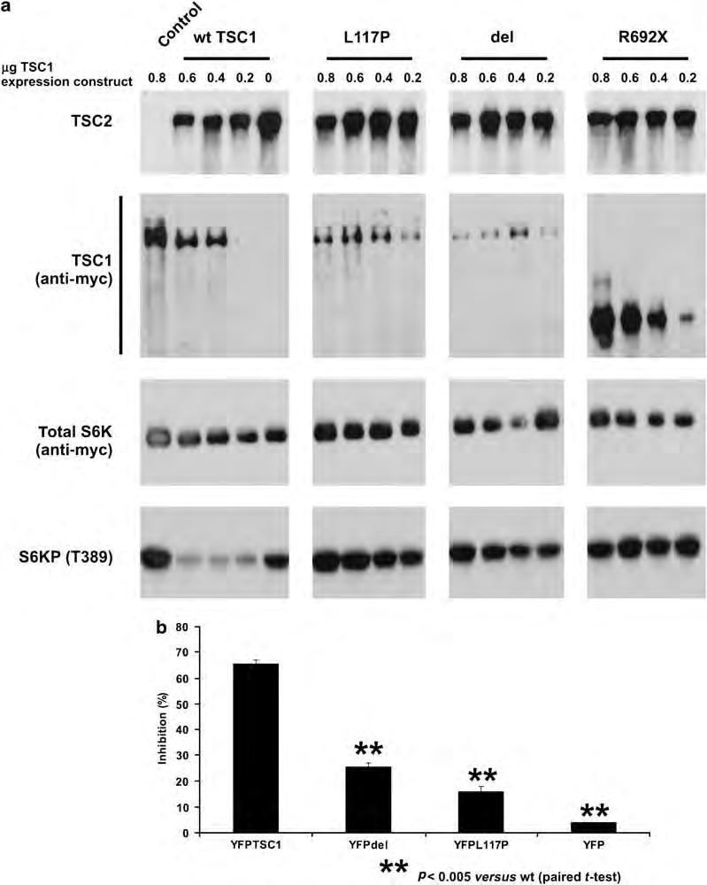 324 Functional analysis of TSC1 variants M Nellist et al Figure 3 TSC1 TSC2-dependent inhibition of mtor signalling by the TSC1 L117P variant.