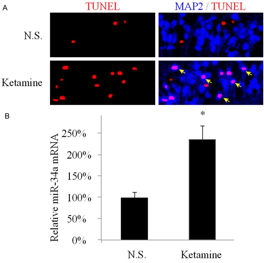 Figure 1. In vivo anesthesia lead to hippocampal apoptosis and upregulation of mir-34a C57/BL6 mice were conducted with I.P. injection of 50 mg/kg ketamine once a day for seven consecutive days.