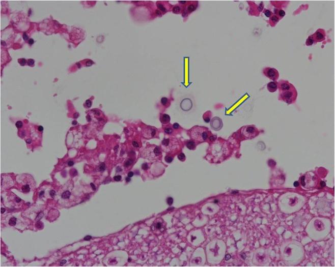 Stilwell and Pissarra BMC Veterinary Research 2014, 10:84 Page 3 of 4 Figure 2 Histopathology exam - several round encapsulated microorganisms (yellow arrow) isolated from the lumbar meninges were