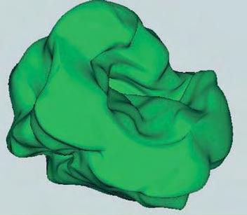 3D-Reconstruction of PTC Nuclei