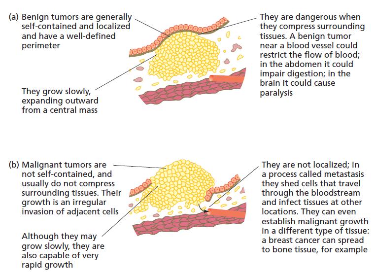 CHAPTER III CANCER CELL 3.2.1 - Types of cancer Figure 3.1 Benign vs. malignant cancers. (a) Benign tumor (b) Malignant tumor (from Almeida, 2010).