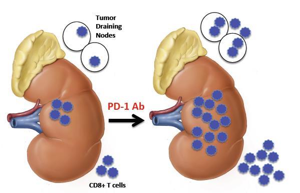 Rationale for Pre-Nephrectomy Anti-PD-1 Priming Harshman Cancer J 2014 Ongoing but unsuccessful anti-tumor T cell response in the tumor, tumor microenvironment, and draining lymph nodes Post-PD-1