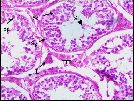 qualitatively\with respect to the tubules, basement membrane and interstitium. The haematoxylin and eosin staining was used to identify the germ cells, leydig cells and interstitial tissue.