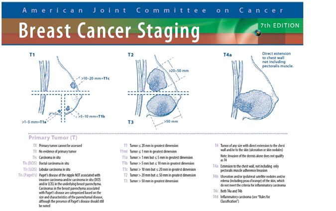 Review the clinical targets for breast RT as a function of cancer stage Learn about innovative uses of advanced