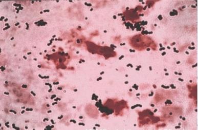 Streptococcus agalactiae (group B Streptococcus): large, round, Gram (+) cocci which are found in pairs, chains and clumps.