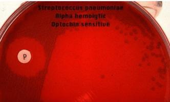 - Bile solubility test for Streptococcus pneumoniae: it distinguishes S,pneumoniae from all other α-hemolytic Streptococci (where S.pneumoniae is bile soluble).