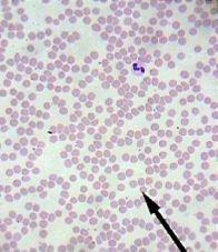 ! Smaller numerous nonnucleic red blood cells Human Blood!