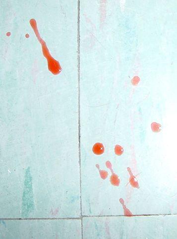 a. Blood Stains The pointed end of the blood