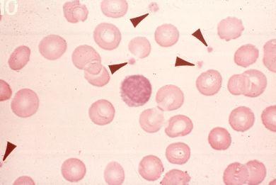 a. Platelets (Thrombocytes)!