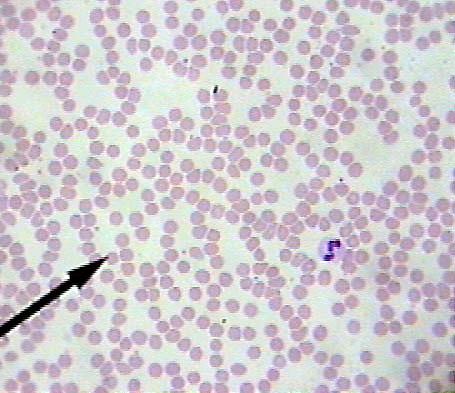 Human Blood Red blood cells are most numerous; 5 to 6 million per mm 3 White blood cells are larger and less numerous;