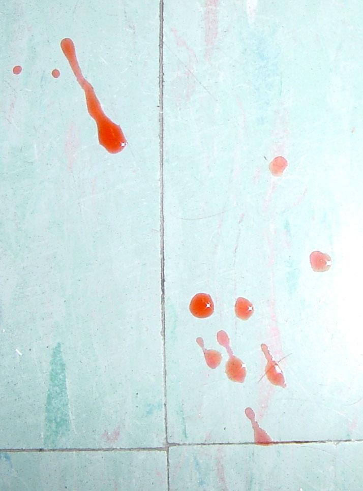 Bloodstain Patterns The harder and less porous the surface, the less the blood drop will break apart.