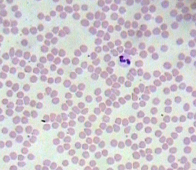 Blood Characteristics Plasma is the fluid portion of the blood (55%) Cells (45%) Erythrocytes are red blood cells. They are responsible for oxygen distribution.