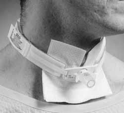 Delivery Systems Trach