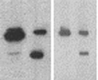 # ALI4409) at 1: 200 dilution in Blocking Buffer for 1 hour at RT and rinse slide 3 x in PBS. 8. Apply ABC reagent (Vectastain Elite) for 30 minutes and rinse slide 3 x in PBS. 9.