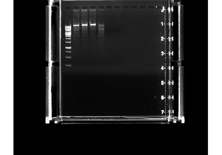 5 NGS coverage data Family 2 (proband) Gap PCR Primer 1 Gap PCR
