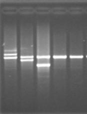Multiplex PCR for α-thalassemia THAI-F SA-F 4.2-F 3.7-F α2-r 4.2-R 3.7-R THAI-R SA-R ξ2 ψξ1 ψα2 ψα1 α2 α1 θ1 -α 3.7 -α 4.2 --SA --THAI Normal fragment; 3.7-F: α2-r = 1,800 bp - α 3.7 fragment ; 3.
