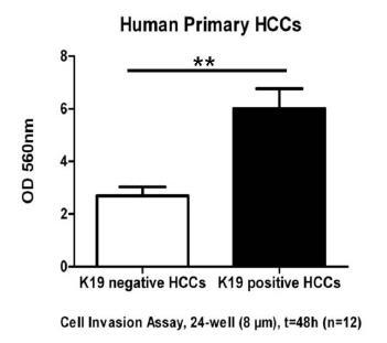 IHC 241 HCC, molecular profiling (mrna, microrna), in vitro