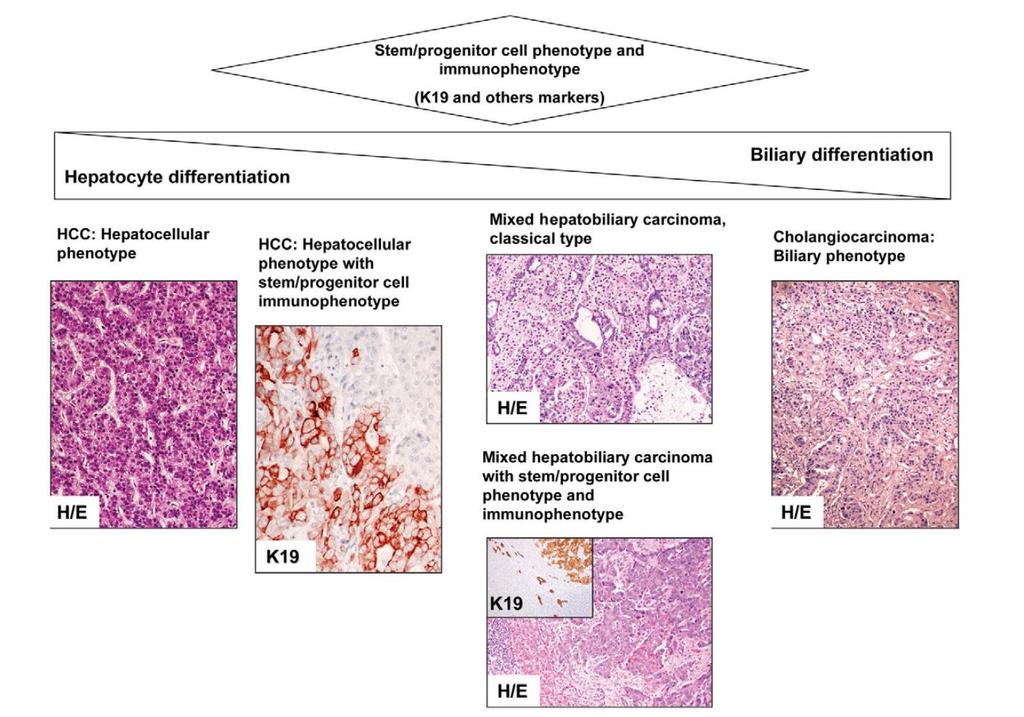 A new approach to histopathological classification