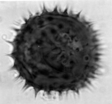 514 AKBAR ALI MEO & MIR AJAB KHAN A B C D Fig. 1. Light micrographs of pollen grains of Calendula species (X1000) Calendula officinalis L. A. Polar view; B. Equatorial view. Calendula arvensis L. C. Polar view; D.