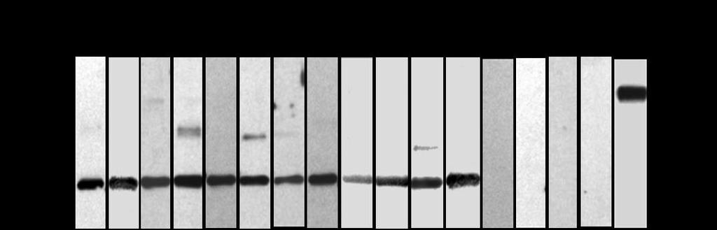 65 Figure 12: Western blot analysis of antisera from immunized guinea pigs.