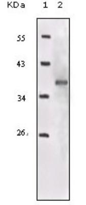 Images Western Blot: IGF-I R Antibody (3G5C1) [NB110-87052] - Analysis using