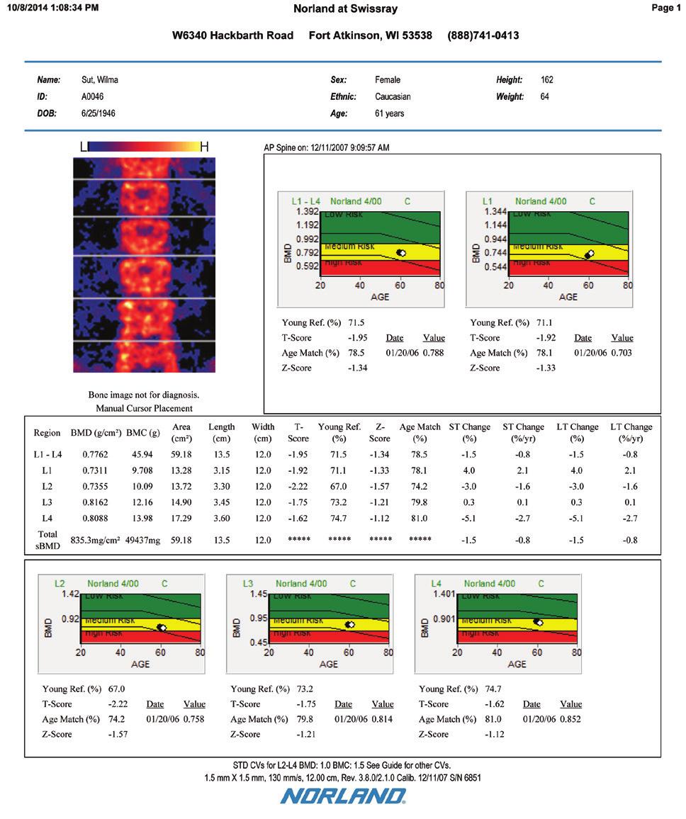 Bone Reports 1. 2. Bone Density Study The initial assessment of bone density is carried out to directly quantify bone in the regions of interest.