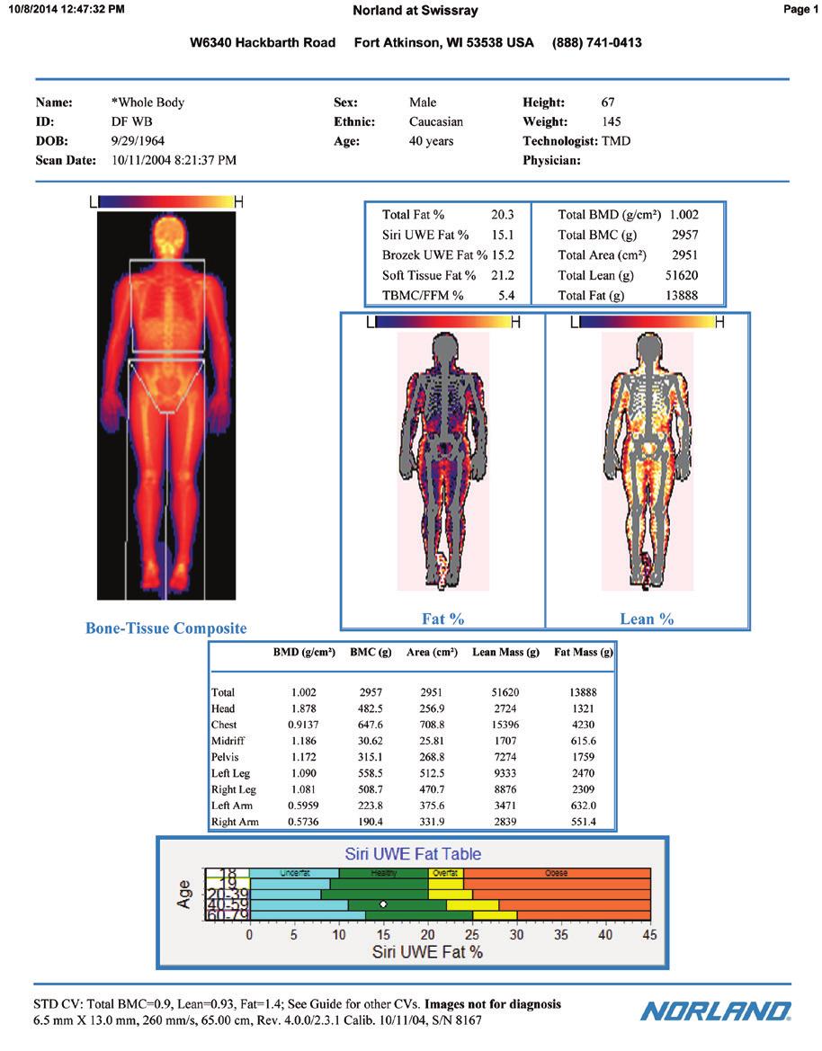 Composition Reports Body Composition Study The initial assessment of body composition is carried out to directly quantify bone, lean and fat mass.