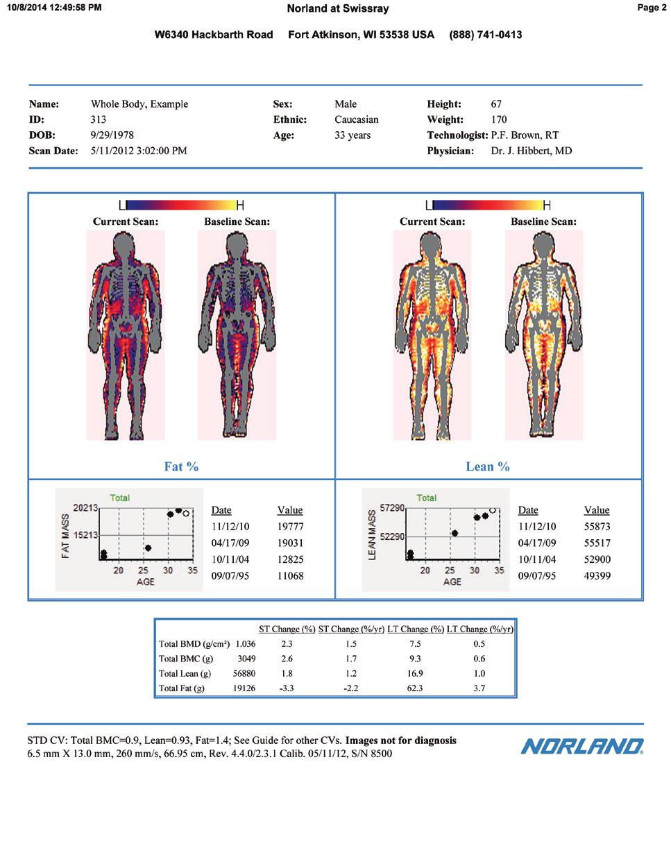 The composition report for an initial study provides: 1. patient background information, 2. an image made up of bone, lean and fat scaled on a minimum to maximum range, 3.