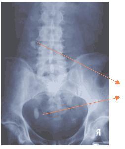 KUB It is the most frequently used radiologic study for the urinary system.