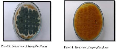 Penicillium spp shows highest prevalence rate (32%) followed by