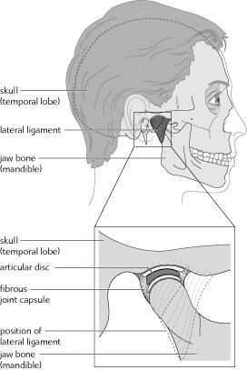 Temporomandibular Joint Disorders A clinical term to describe the musculoskeletal disorders affecting the