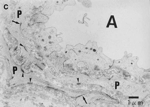 (B) Transmission electron microscopy photograph of the area surrounded by the box in (A). Two kinds of canalicular structures (A, C) are noted in the area corresponding to the collector channels.