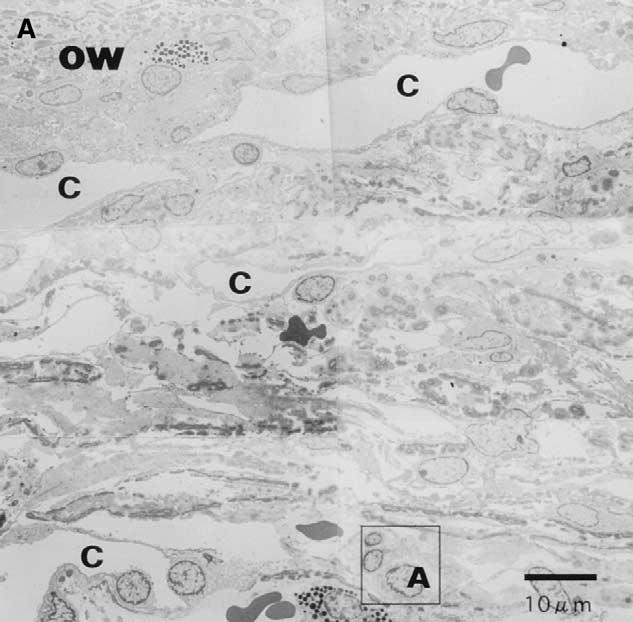 154 Jpn J Ophthalmol Vol 47: 151 157, 2003 Figure 5. (A) Transmission electron microscopy photograph of the area corresponding to the Schlemm canal and the juxtacanalicular connective tissue.