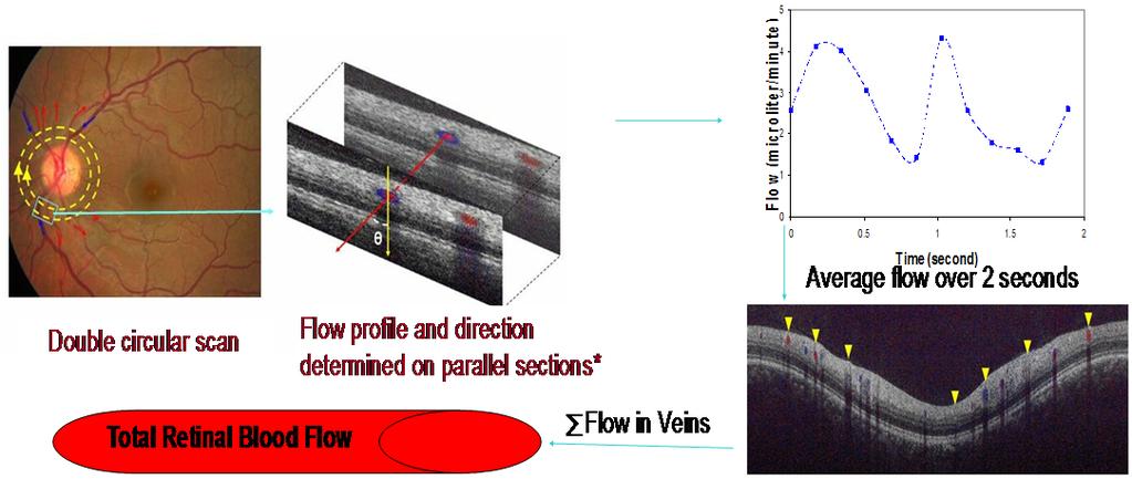 Total Retinal Blood Flow Calculation Using Double circular scan 2 sin α : wavelength : Doppler shift : refractive index Doppler angle α 90 Average flow over 2 seconds Dual-circular scan Flow profile