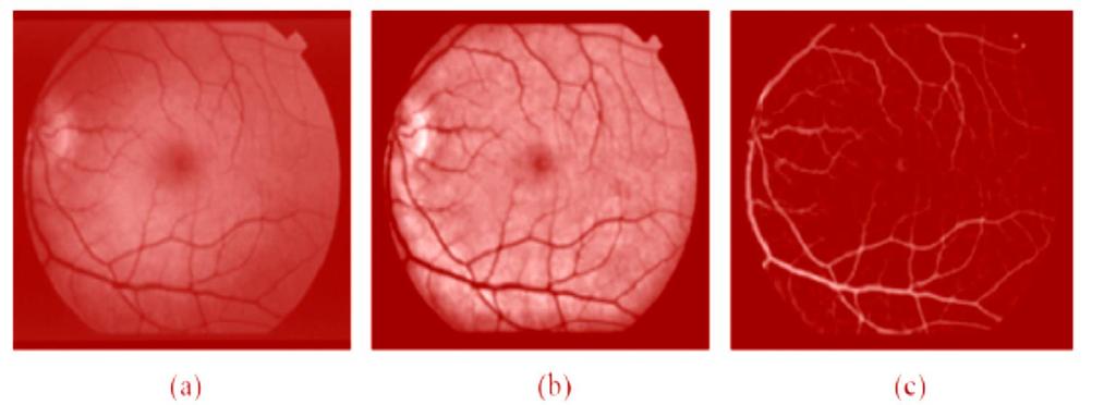 2.2.1 Pre-Processing Color fundus images often show important lighting variations, poor contrast and noise.