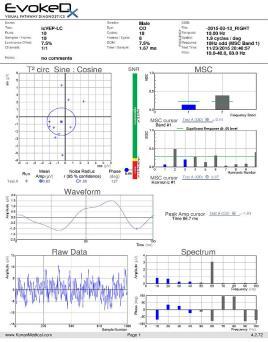 Isolated-Check VEP Testing icvep Testing Right Eye Technology uses an isolated-check stimulus pattern to generate the VEP waveform Test strategy includes a low-contrast, isolated bright or dark-check