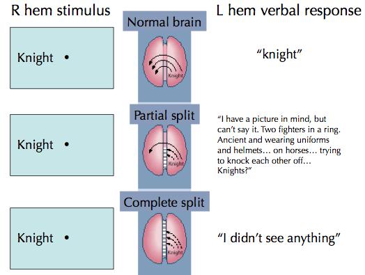 (a) normal brain full communication R hemi tells L hemi to say knight (a) partial split some communication R hemi sees word L hemi has to phish for word (b) complete split no communication R hemi