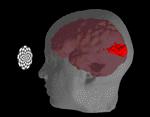 f MRI example Amygdala