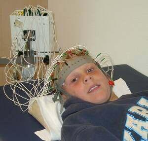Electroencephalogram EEG Detects brain waves through