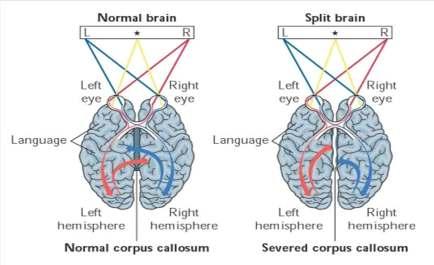 A Tour Through The Brain: Severing the corpus callosum provides data