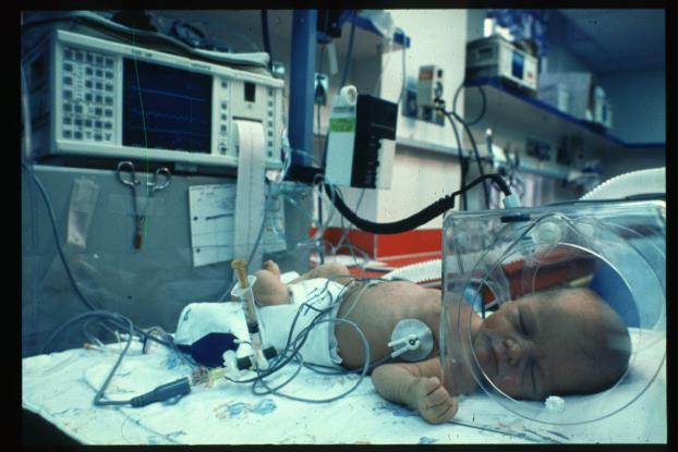 RSV is The leading cause of hospitalization in infants and in many high-income countries;