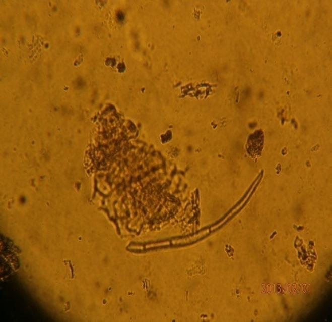 paracytic stomata B5: Glandular
