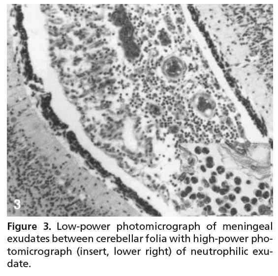furfur Death occurred on day 86 Autopsy findings Inflammatory reactions of meninges consistent with meningitis Histopathological examination (silver stained sections) revealed meninges contained