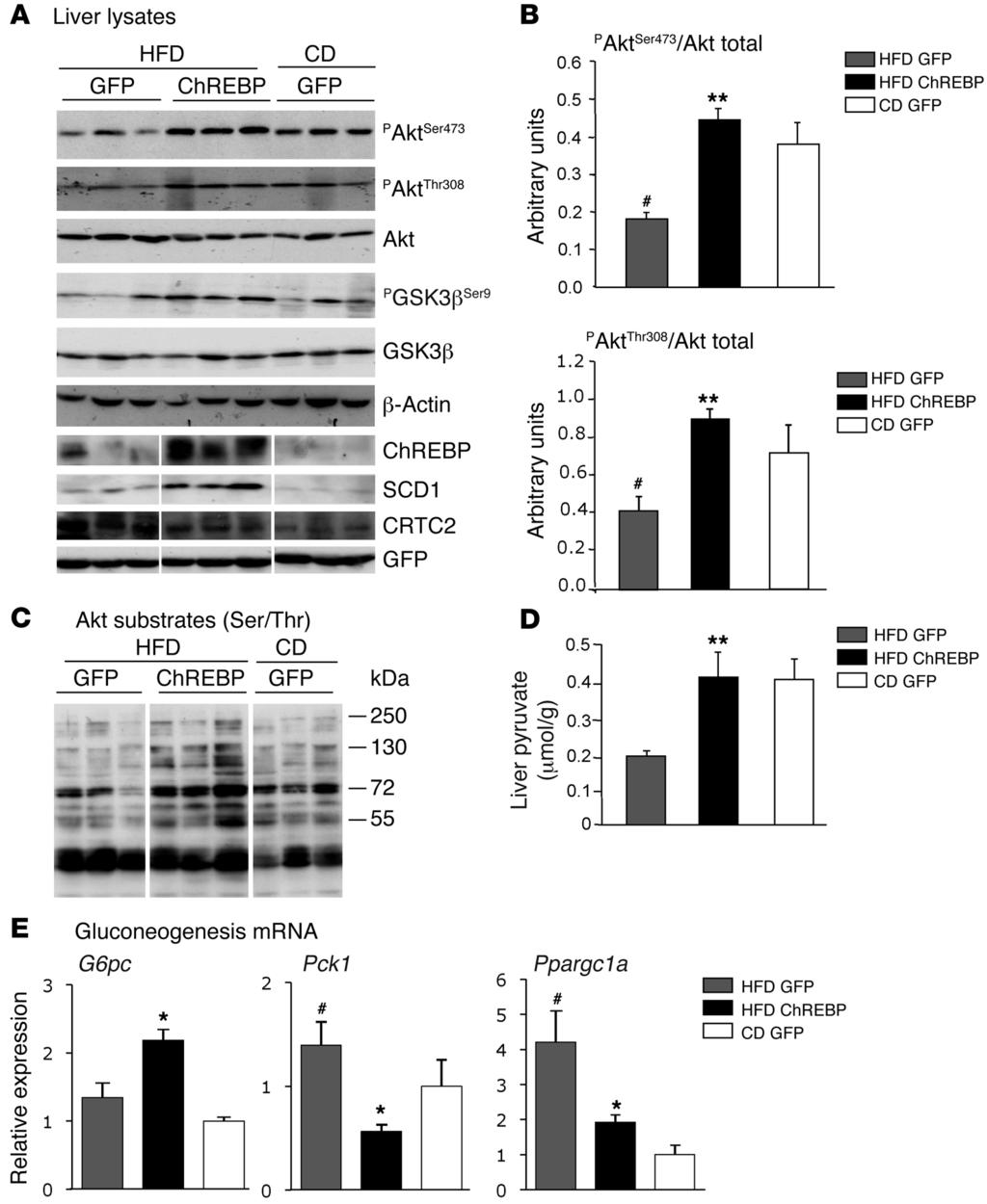 Figure 9 Improved Akt phosphorylation in livers of HFD-fed ChREBP mice. All analyses were carried out in HFD-fed GFP and ChREBP mice, as described in the Methods section.
