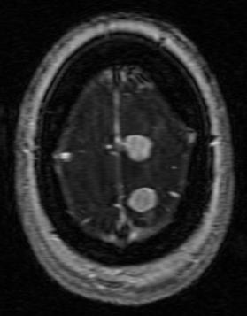 Dural tail is visible. Fig. 6.