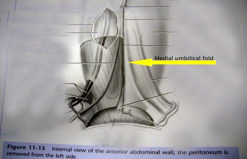 Median umbilical ligament The median umbilical ligament or Xander s ligament. It extends from the apex of the bladder to the umbilicus, on the deep surface of the anterior abdominal wall.